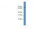 Clcn5 antibody - middle region